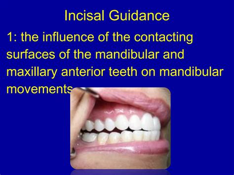 9. anterior teeth arrangement | PPT