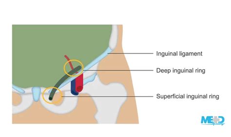 Superficial Inguinal Ring