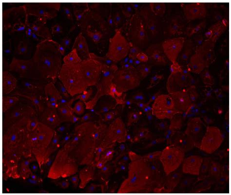 11 Intriguing Facts About Alveolar Type II Cells - Facts.net