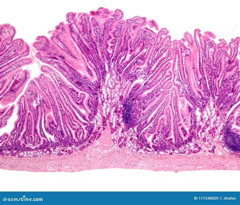 Duodenum. Brunner’s Glands Royalty-Free Stock Photography ...