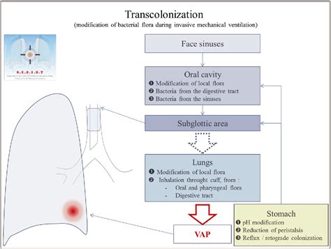 Figure 1 From Ventilator‐associated Pneumonia The Central Role Of Transcolonization Semantic