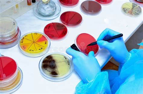 Petri Dish Laboratoire Microbiologique Image Stock Image Du Cultures