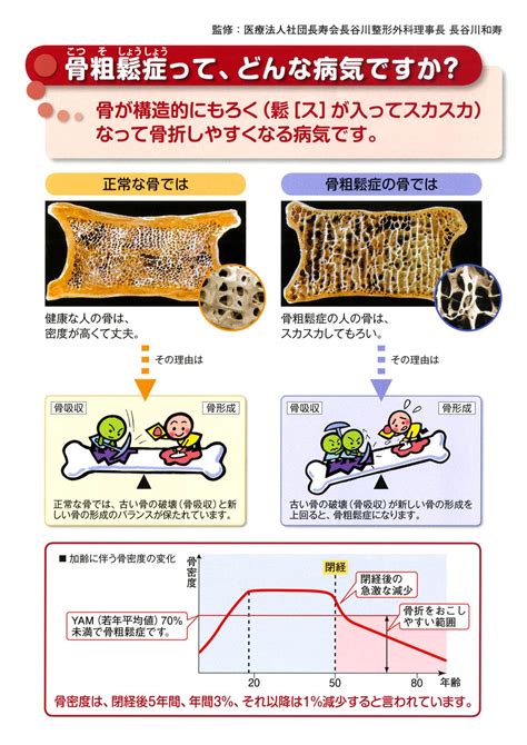 骨粗鬆症について 長谷川整形外科