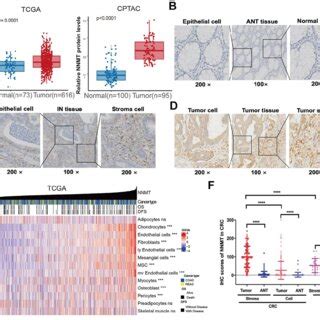 The Relationship Between Positive Expression Of NNMT In Tumor Cell And