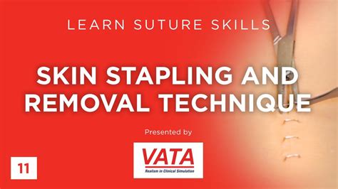 Skin Stapling And Removal Technique Learn Suture Techniques Vata