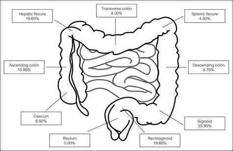 Colonoscopic Localization Accuracy For Colorectal Resections In The