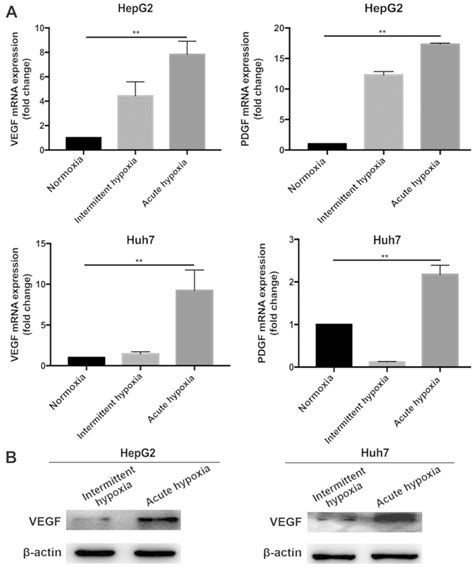 Intermittent Hypoxia Alleviates Increased VEGF And Proangiogenic