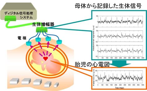 研究シーズ詳細情報（no396） 生体信号の解析と視覚化 東北大学 研究シーズ集