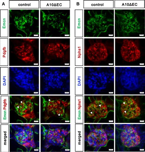 Immunofluorescence Analysis Of Glomeruli With Markers For Endothelial