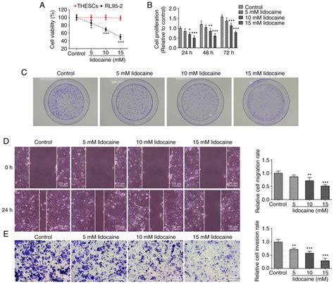 Lidocaine Inhibits The Proliferation And Migration Of Endometrial Cancer Cells And Promotes