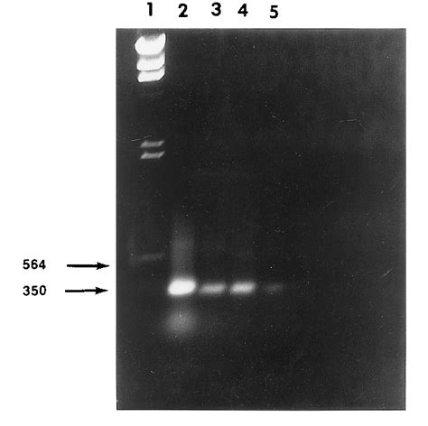 Pcr Amplification Products Using 16s Rrna Gene Specific Primers Lanes Download Scientific