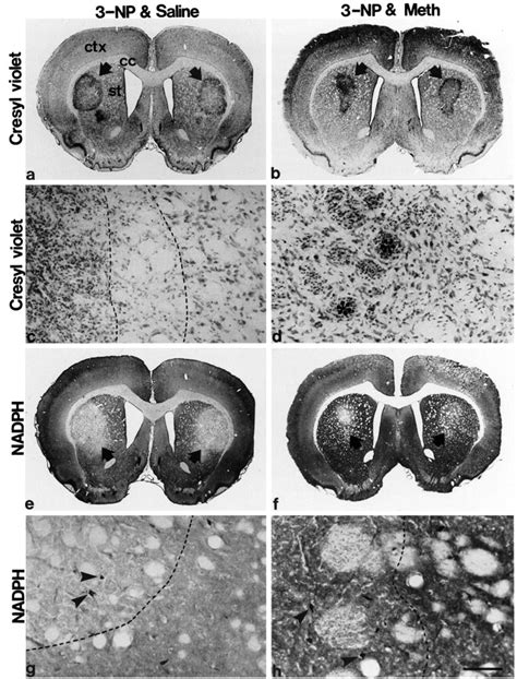 Dopamine Modulates The Susceptibility Of Striatal Neurons To