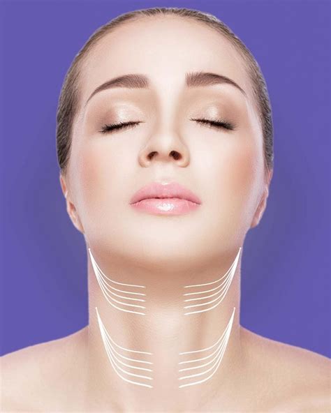 Nefertiti Neck Lift Keem Medical Aesthetic Clinic