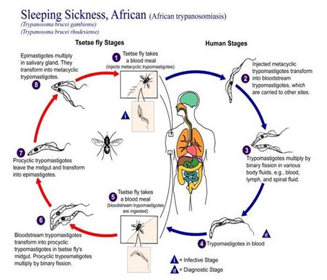 Sleeping Sickness Causes Symptoms Treatment Diagnosis And