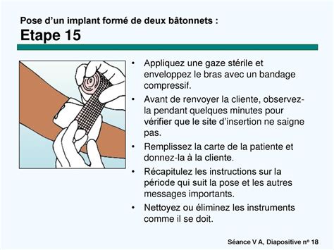 Implants contraceptifs ppt télécharger