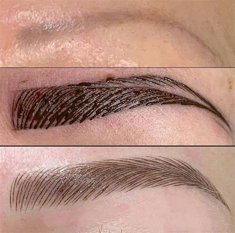 Fixing Bad Microblading When To Correct And When To Remove