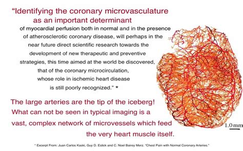 Microvascular Angina