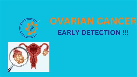 Cancer Ovary Early Detection Youtube