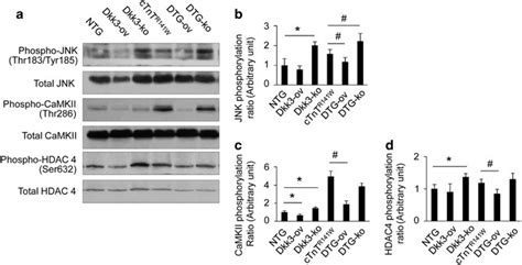 dkk prevents familial dilated cardiomyopathy development  wnt