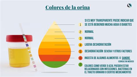 No Tires Tan R Pido De La Cadena Lo Que La Orina Y Las Heces Dicen De