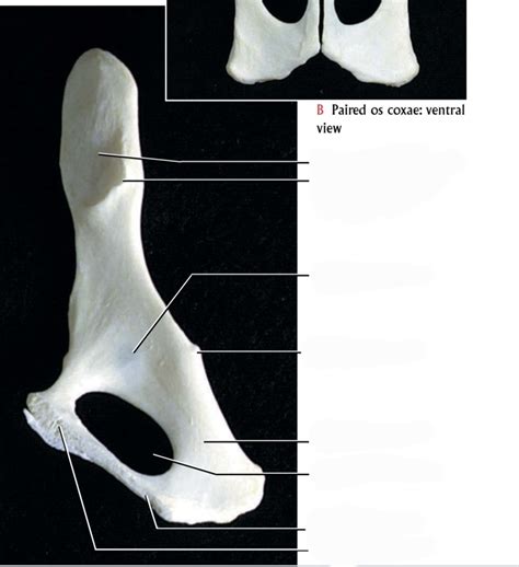 Diagram Of Medial Os Coxa Quizlet