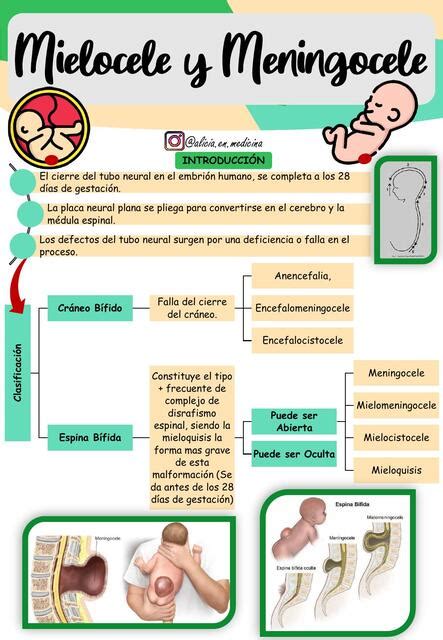 Mielocele Y Meningocele Alicia En Medicina By Gabriela Soplin