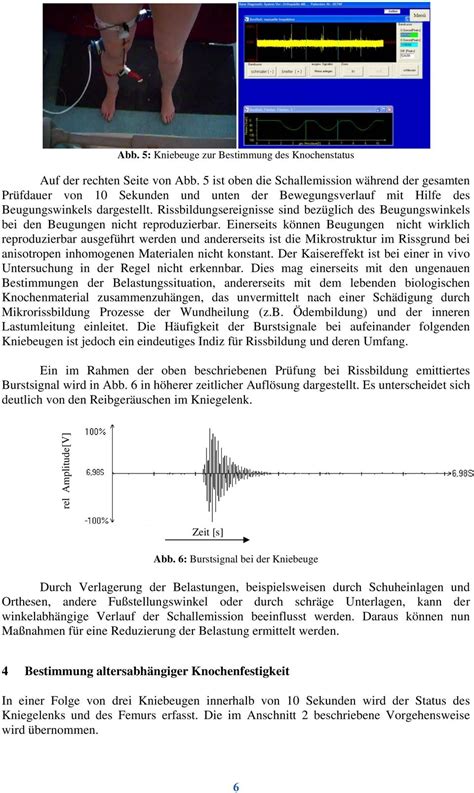 Nachweis Der Rissbildungsgrenze Des Humanen Femurs Mit Hilfe Der