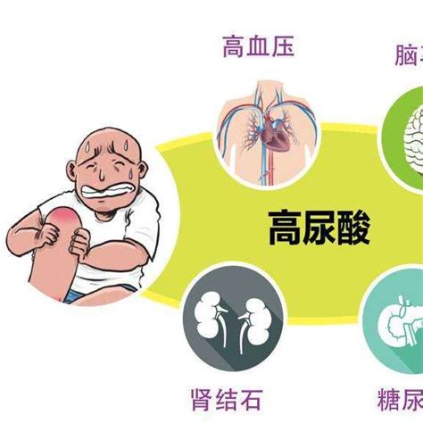 痛风的四阶段症状百度百科