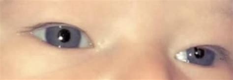 My dark blue/greyish eyes as a baby 💙🩶 : r/eyes