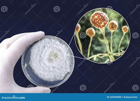 Colony Of Mucor Fungi Grown On Petri Dish Also Known As Black Fungus