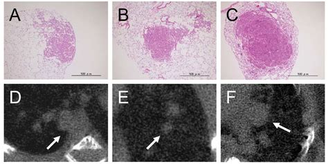 Figure 3 Non Invasive X Ray Micro Computed Tomographic Evaluation Of