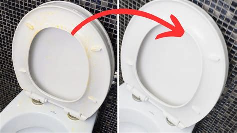 How To Remove Yellow Stains From Your Toilet Seat Tricks And Lifehacks