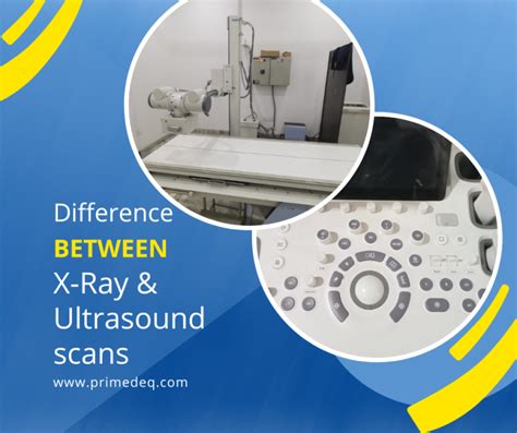 Difference Between X Rays And Ultrasound Scans Primedeq Blog