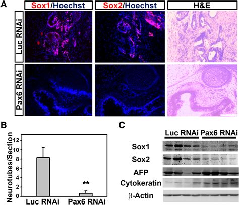 Pax6 Is A Human Neuroectoderm Cell Fate Determinant Cell Stem Cell