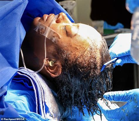 Woman Who Sprayed Her Hair With Gorilla Glue Finally Has It Removed