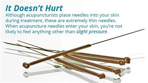 10 Things You Should Know About Acupuncture Treatments