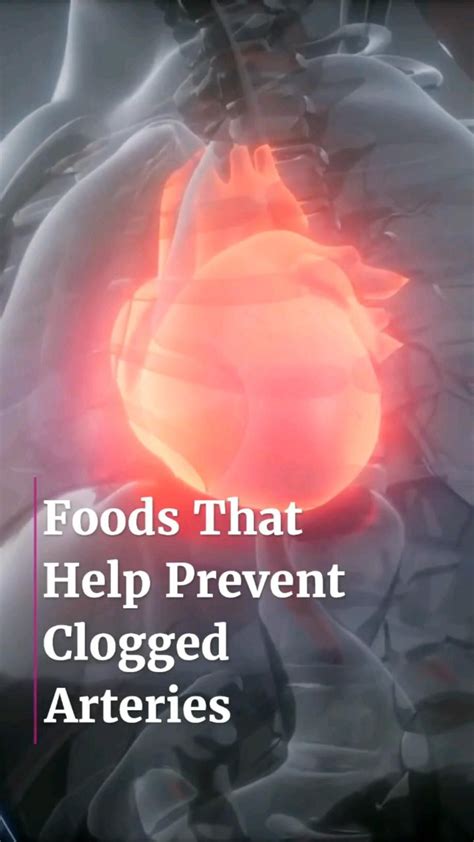 Foods That Help Prevent Clogged Arteries Artofit