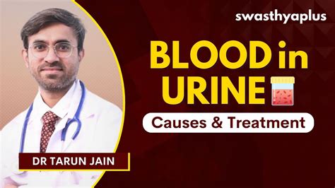 What Is Hematuria How To Deal With Blood In Urine Treatment