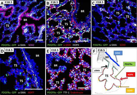 Association Of Pdgfrα Gfp Fibroblasts With Distinct Epithelial