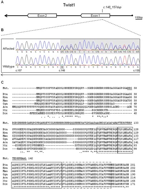 A TWIST1 Gene S Organization Scheme B DNA Sequencing Chromatograms