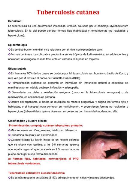 Tuberculosis cutánea apun tesmedicina uDocz