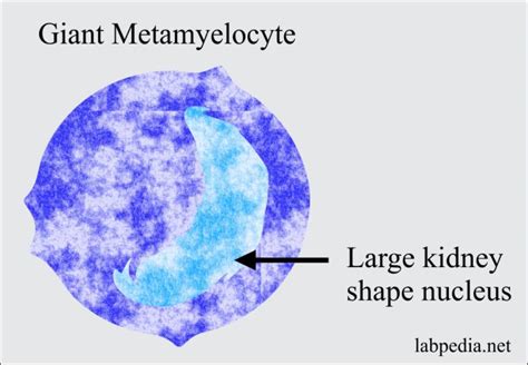 Hematology Labpedia Net