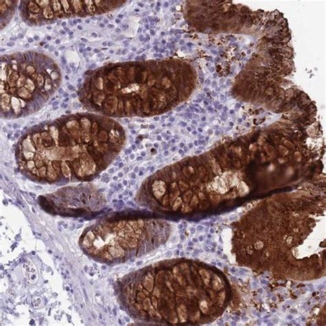 Beta 1 4 Galactosyltransferase 2 B4GalT2 Antibody Novus Biologicals 0