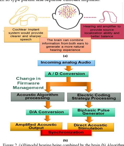 Figure 2 From Bimodal Cochlear Implant Processing Based On Assisted