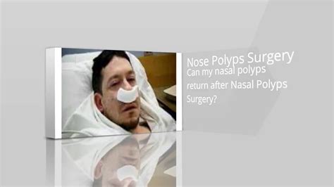 Nasal Polyps Surgery Can My Nasal Polyps Return After Nasal Polyps