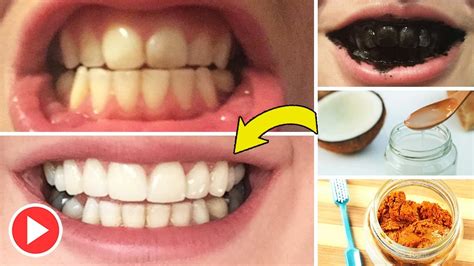 How To Whiten Teeth At Home Naturally Whiten Your Teeth With A 100