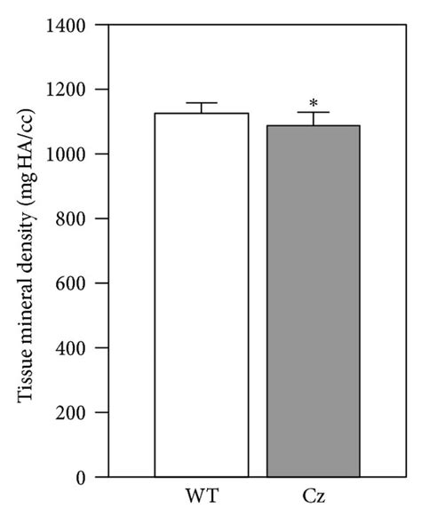 Diminished Cortical Bone Volume And Density In The Long Bones Of Fgfr