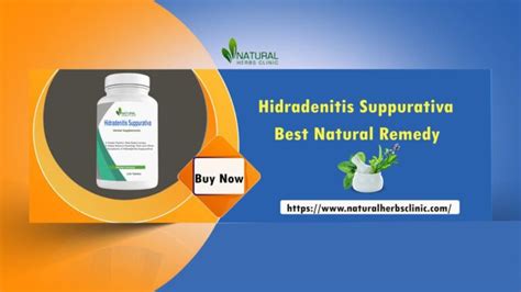 Herbal Remedies For Hidradenitis Suppurativa Symptoms Causes Treatment Natural Herbs Clinic