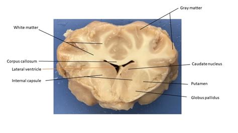 Sheep Brain Coronal Slice Diagram Quizlet