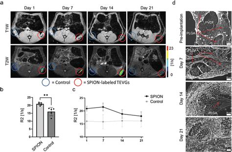 In Vivo Longitudinal Monitoring Of Spionlabeled Plga Degradation A